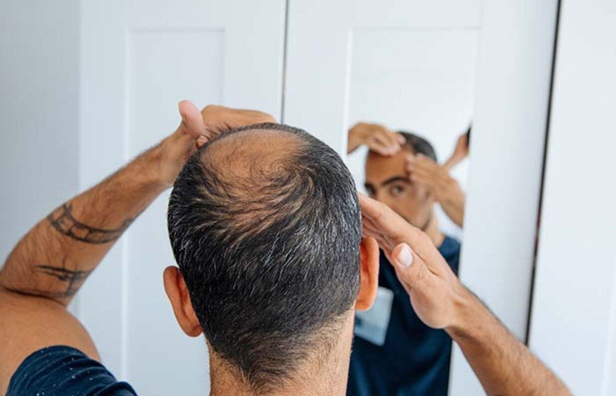 Hair Loss hero image